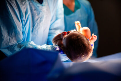 Baby delivered during C Section procedure in Hospital Operating Room